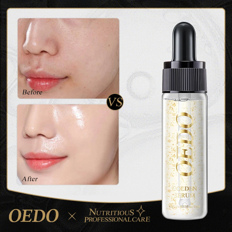OEDO Gold liquid Moisturizing Serum Facial Plant Skin Care Anti Aging Anti Wrinkle Whitening Cream Facial Treatment Essence