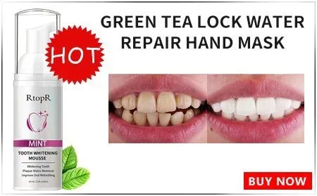 Moisturiser Face Whitening Freckle Cream Remove Acne Spots Melanin Dark Spots Face Lift Firming Face Skin Care Bright Skin Cream