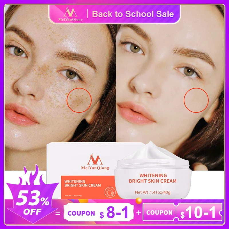 Moisturiser Face Whitening Freckle Cream Remove Acne Spots Melanin Dark Spots Face Lift Firming Face Skin Care Bright Skin Cream