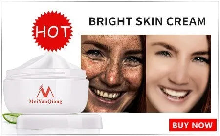 Moisturiser Face Whitening Freckle Cream Remove Acne Spots Melanin Dark Spots Face Lift Firming Face Skin Care Bright Skin Cream
