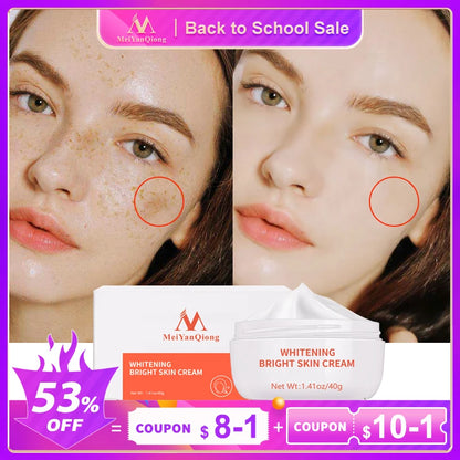 Moisturiser Face Whitening Freckle Cream Remove Acne Spots Melanin Dark Spots Face Lift Firming Face Skin Care Bright Skin Cream